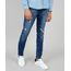 Calca-Jeans-Masculina-Skinny-com-Recortes-e-Rasgos-Azul-Medio-9532783-Azul_Medio_1
