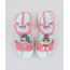 Rasteira-Infantil-Ipanema-LOL-Surprise-Estampada-Verde-Claro-9470456-Verde_Claro_1