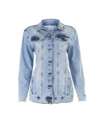 Jaqueta-Jeans-Pat-Pat-s-Azul-Claro-8577172-Azul_Claro_5