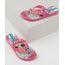 Chinelo-Infantil-Ipanema-LOL-Surprise-Estampado-Rosa-9954704-Rosa_1