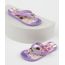 Chinelo-Infantil-Ipanema-LOL-Surprise-Estampado-Lilas-9954706-Lilas_1