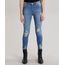 Calca-Jeans-Super-Skinny-Azul-Medio-8704157-Azul_Medio_1