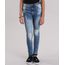 Calca-Jeans-Destroyed-Azul-Medio-8825074-Azul_Medio_1