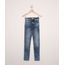 Calca-Jeans-Juvenil-Skinny-Marmorizada-com-Rasgo-no-Joelho-Azul-Medio-9966610-Azul_Medio_1