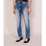 Calca-Jeans-Masculina-Slim-Marmorizada-Azul-Medio-9980915-Azul_Medio_1