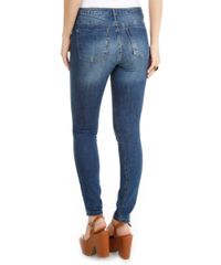 Calca-Jeans-Skinny-Azul-Medio-8118136-Azul_Medio_2