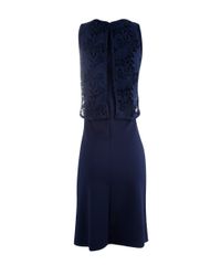 Vestido-Texturizado-com-Renda-Azul-Escuro-8117746-Azul_Escuro_6