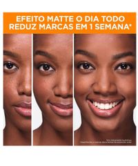 Kit-Antimarcas-Garnier-Uniform---Matte-Vitamina-C---Limpeza-Facial---Agua-Micelar---Protetor-Hidratante-Unico-1038920-Unico_5 Kit-Antimarcas-Garnier-Uniform---Matte-Vitamina-C---Limpeza-Facial---Agua-Micelar---Protetor-Hidratante-Unico-1038920-Unico_5