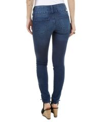 Calca-Jeans-Skinny-Azul-Escuro-8255258-Azul_Escuro_2