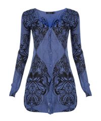 Cardigan-Floral-Ateen-Azul-8166630-Azul_5